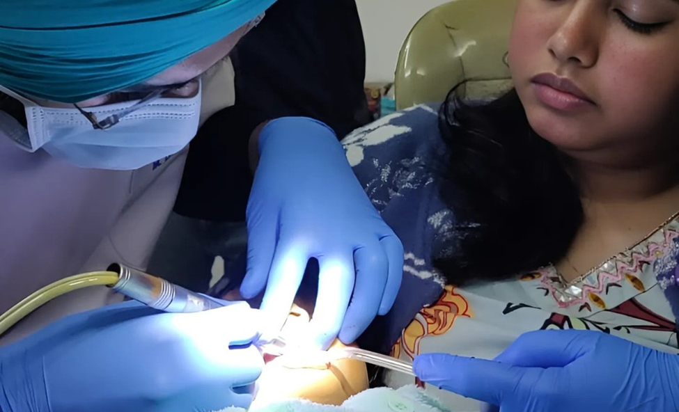 Advantages of Root Canal Treatments