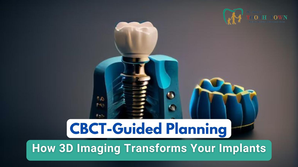 CBCT Implant Planning | Transform Your Dental Precision