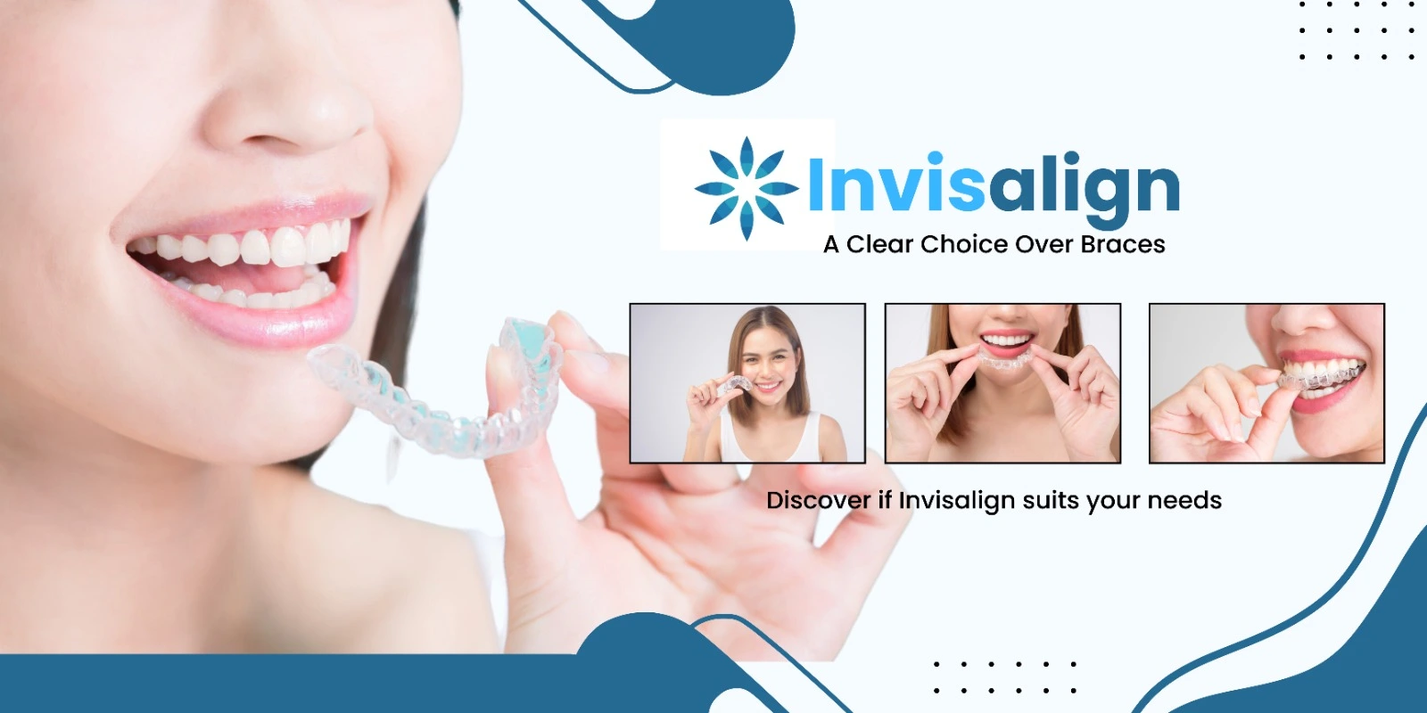 Dental Invisalign 