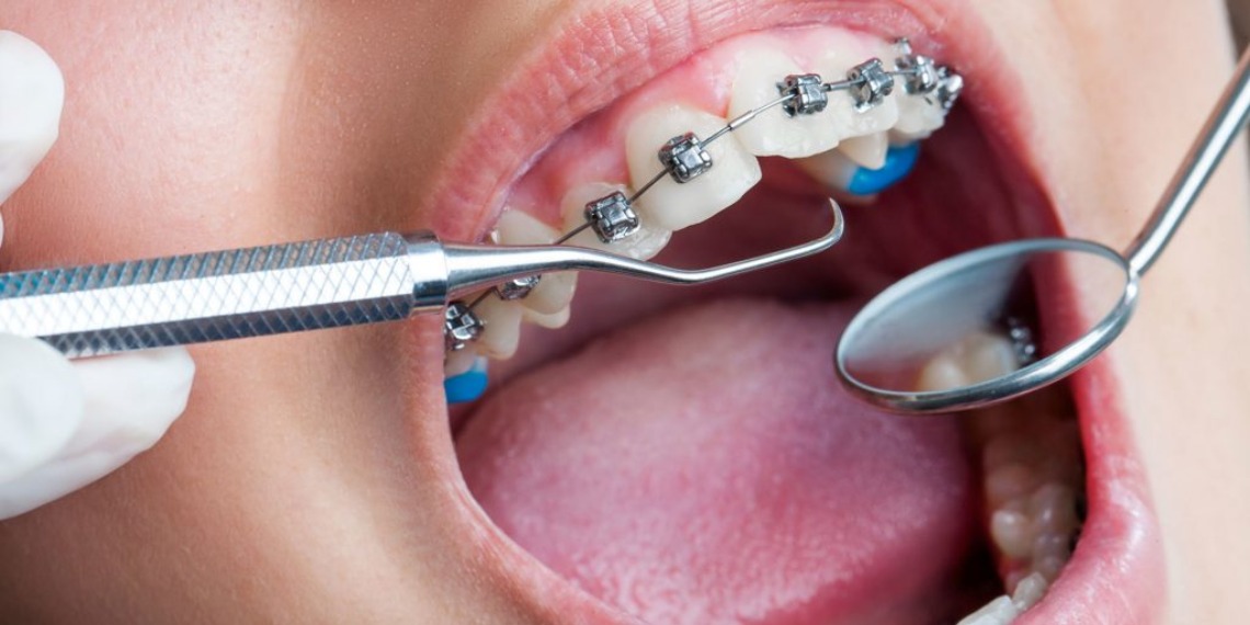 orthodontist