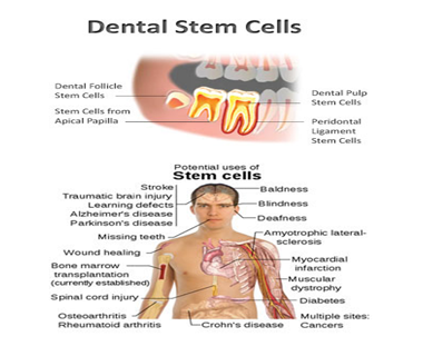 Stem Cell Banking